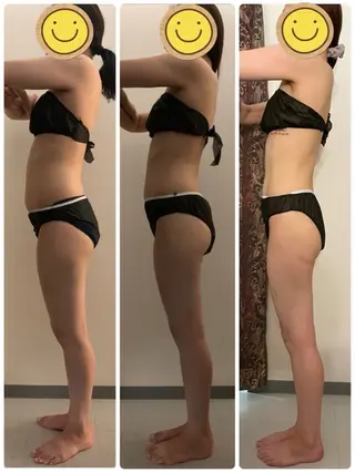 高速脱毛エステ リアンのエステ・リラクイメージ