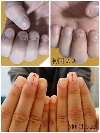 ネイル 林 禅のネイルデザイン