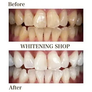 ホワイトニング ショップ津店のその他イメージ