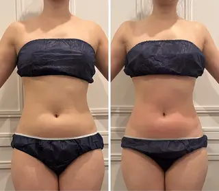 小顔×美肌デザイン✨ 理想へトータルケア◎のエステ・リラクイメージ