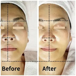 自然派フェイシャル やながわのエステ・リラクイメージ