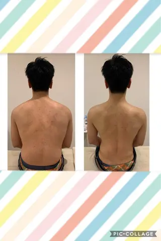 朝重い人専用 肩甲骨調整のエステ・リラクイメージ