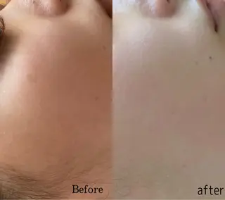 整♡深層リンパ ronronのその他イメージ