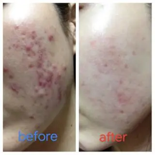 メンズ 朝重い人専用 肩甲骨調整のエステ・リラクイメージ