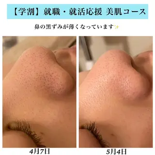 Bellesthe (ベルエステ)のエステ・リラクイメージ