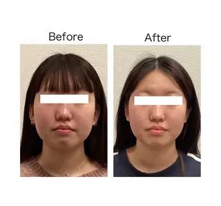 小顔サロン sharpのエステ・リラクイメージ