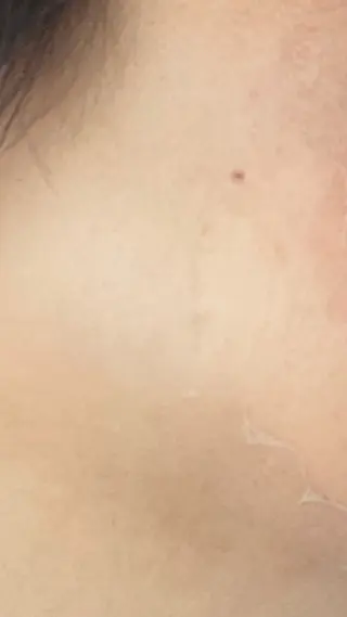 brilliance所属・老化肌トラブル肌専門 Brillianceのエステ・リラクイメージ