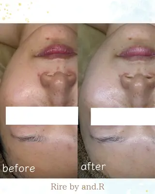 長野 美里のエステ・リラクイメージ