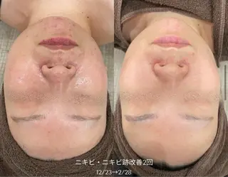 Tug エステサロン　高知駅前店所属・高知駅店Tug NONOKAのエステ・リラクイメージ