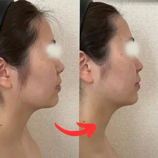 小顔コルギ&肌質改善 の専門店LIBREのエステ・リラクイメージ