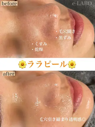 e-LABO こいずみのエステ・リラクイメージ