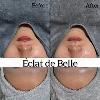 Éclat de Belle🫧白玉肌のその他イメージ