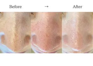 韓国式3D毛穴洗浄 lonhanaのその他イメージ