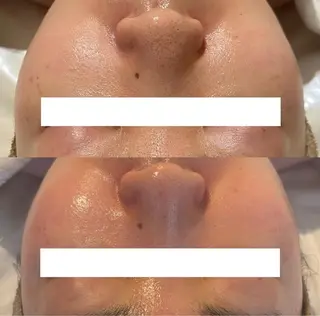 中目黒ハーブピーリン グ🌿ララピールのエステ・リラクイメージ