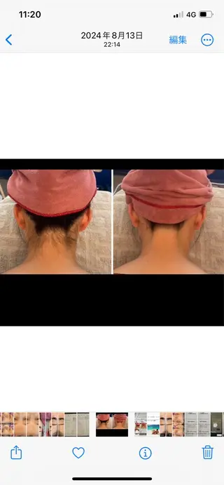 ニキビ/疲労回復ケア シェソワのエステ・リラクイメージ