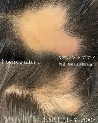 メンズ 毛穴改善サロン d'Alba大阪住吉のエステ・リラクイメージ