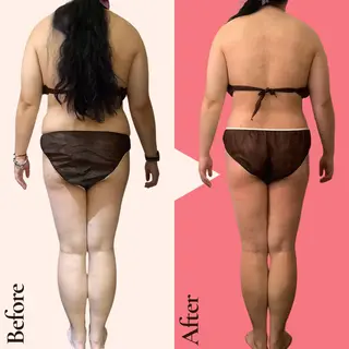 痩身ダイエット専門店 プレシャスのエステ・リラクイメージ