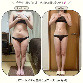 《本気痩せ×疲労改善 》  BILOOPのエステ・リラクイメージ