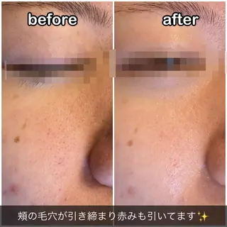 ビューティサロン プレジールOTAKEのエステ・リラクイメージ