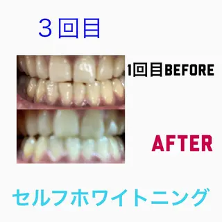 Raffoler りさのエステ・リラクイメージ