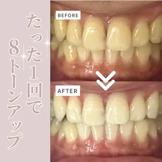 LIBRA自由が丘 ホワイトニングのその他イメージ