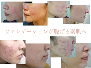 肌能力回復専門店 小寺綾のエステ・リラクイメージ