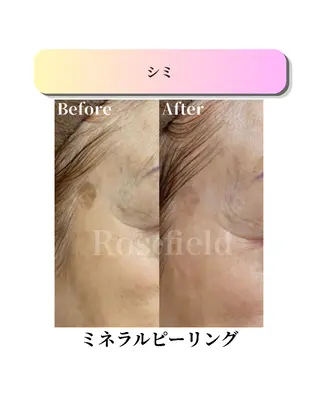 ローズフィールド 森岡朋美のエステ・リラクイメージ