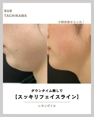 メンズ 【BUB立川】 ゆかのエステ・リラクイメージ