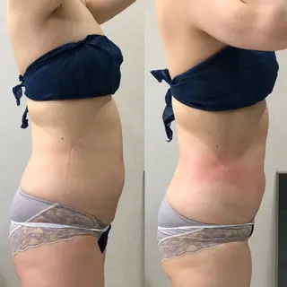 MY corailのエステ・リラクイメージ