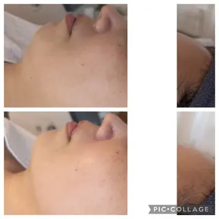 デ・アイム王寺所属・肌改善エミリーノ 米田真美子のエステ・リラクイメージ