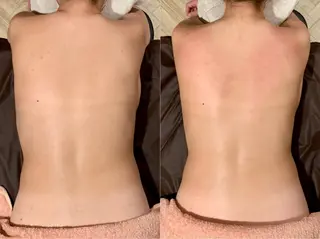 Rewhite -リホワイト-のエステ・リラクイメージ