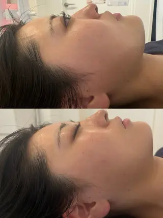 美容鍼灸サロン mahoroba院長のエステ・リラクイメージ