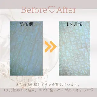 Mr.&Ms.脱毛/ ピーリング/RINAのエステ・リラクイメージ