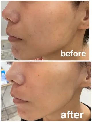 Beauty Salon Lunaのエステ・リラクイメージ