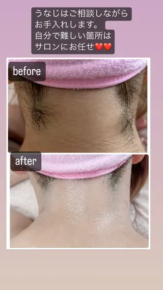 美肌脱毛fuu okinawa所属・宜野湾美肌脱毛fuu okinawaタイラのエステ・リラクイメージ