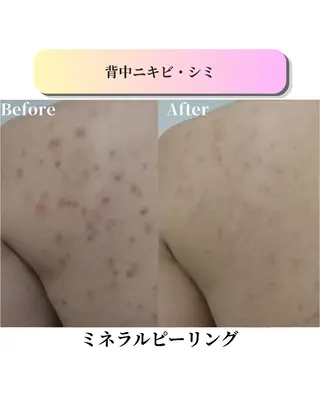 ローズフィールド 森岡朋美のエステ・リラクイメージ