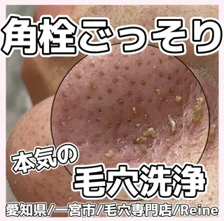 毛穴/シミ肝斑/脱毛 横山梨里のエステ・リラクイメージ