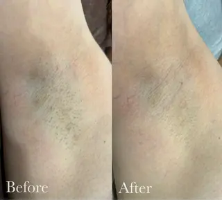 美容鍼脱毛salon リノン吹田駅前店のエステ・リラクイメージ