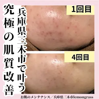 ハーブピーリング 専門／今榮麻美のエステ・リラクイメージ