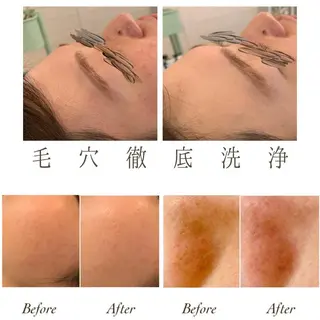 ange rose所属・竹澤 亜希子のエステ・リラクイメージ