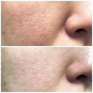 サロンur（ユア） Rieのエステ・リラクイメージ