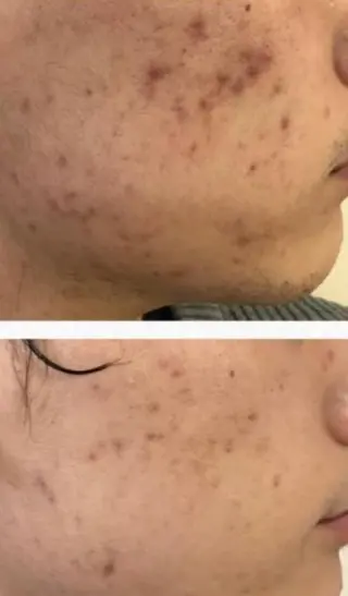 朝重い人専用 肩甲骨調整のエステ・リラクイメージ