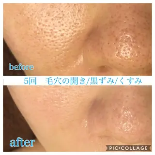 ロング カラー パーマ ヘアアレンジ キッズ ネイル マツエク・マツパ EnsorClair 代表 野口真央のエステ・リラクイメージ