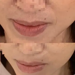 emiluca🫧 中須のエステ・リラクイメージ