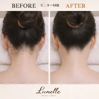 脱毛×肌管理サロン ルネルのエステ・リラクイメージ
