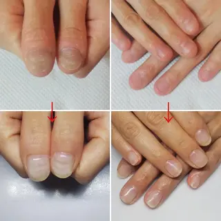 ネイル ネイルサロン アリュームのネイルデザイン