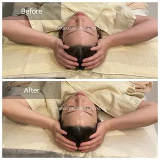 脳洗浄✳︎マツヤニ/ みつこのエステ・リラクイメージ