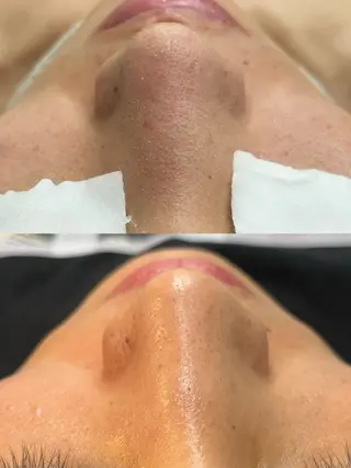 EPIL risaのマツエク・マツパデザイン