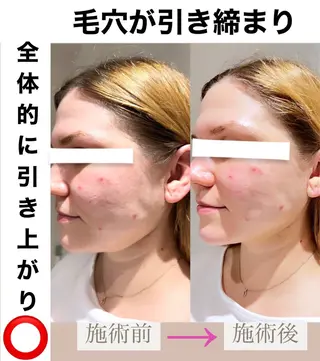 脱毛&美容サロン BLUESEAのエステ・リラクイメージ