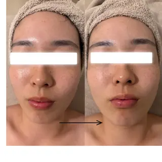 UEDA | POLA 天王寺のエステ・リラクイメージ